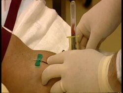 CU Doctor taking blood sample via butterfly needle and vacuum sample tube Stock Footage