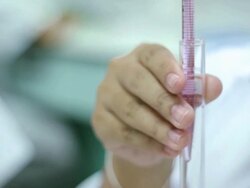 Medical students are tested chemically,Close-up Stock Footage