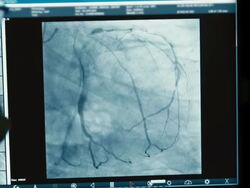 Radiologist monitoring injection process into blood vessels Stock Footage