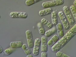Cells showing chloroplasts containing chlorophyll and cell walls.  Probably a filamentous algae Stock Footage