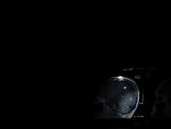 MRI Scan of human brain Stock Footage