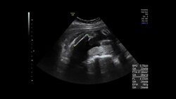 Ultrasound Stock Footage