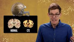 Why Don't Woodpeckers Get Concussions? Instructional Video