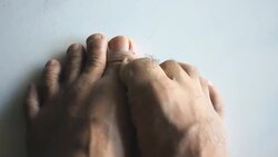 Itch Foot Stock Footage