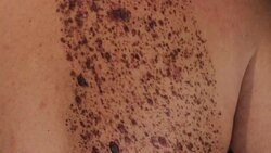 unusual beauty spots Stock Footage