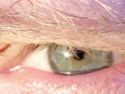 Eye Close Up Stock Footage