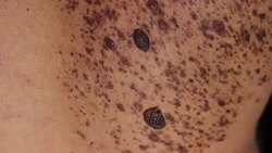 unusual beauty spots Stock Footage