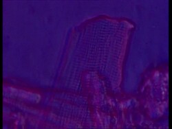 BCU Microscopic view of heart muscle contracting Stock Footage