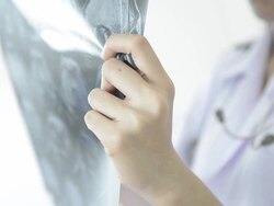 Doctor reading MRI film result Stock Footage