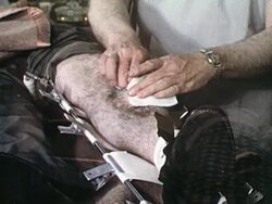 Doctor examing patient's leg wound Stock Footage