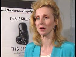 UK: LONDON: TWIN ABORTION CASE OPENS UP WORLD DEBATE News Clip