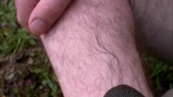 A leech sucks blood from a man's arm. Stock Footage