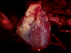 Heart Rate Stock Footage