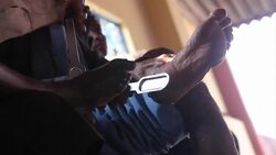 VOICED : Stigma stalks India's leprosy sufferers as disease returns News Clip