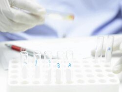 scientist testing blood group Stock Footage
