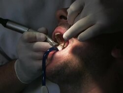 Dentist at work Stock Footage