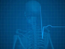 Human Skeleton With Pulse Trace Stock Footage