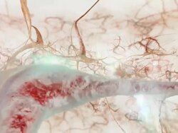 Brain Neurons Tracking warm Stock Footage