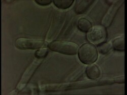 Candida albicans, live Thrush fungus, time lapse fungal hyphae growing Stock Footage