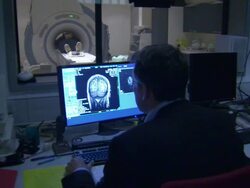 New brain scanner to diagnose autism News Clip