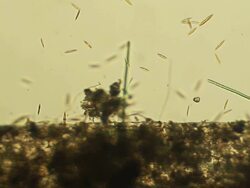 Micro organisms: diatoms Stock Footage