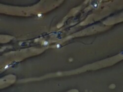 Human sperm, single sperm swimming, head looks deformed Stock Footage