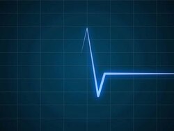 EKG / Electrocardiogram /Pulse Waveform with sound Stock Footage