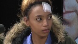 CLEAN : Model assaulted by Grace Mugabe gives press conference News Clip