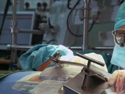 Focused surgeon operates a patient Stock Footage