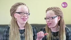 Twins With Albinism Wear Their Condition With Style | SHAKE MY BEAUTY Instructional Video