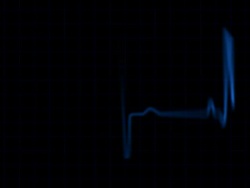 Pulse Trace Stock Footage