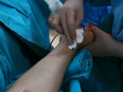 Angiography Stock Footage