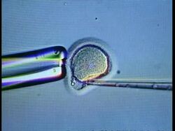 Egg being fertilised under microscope Stock Footage