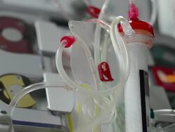 Dialysis Stock Footage