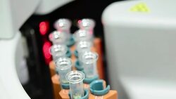 close-up of blood automed analysis device for diacnostic Stock Footage