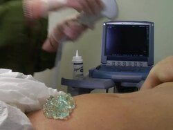 Ultrasound to determine pregnancy Stock Footage