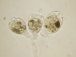 MIcroorganisms - ciliate Scyphidia Stock Footage