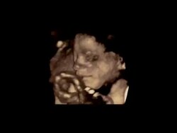 Foetus face up close, rotating 3D ultrasound scan.. Stock Footage