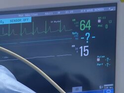 Heart Monitor Stock Footage
