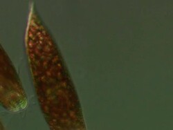 Euglenoids differential interference contrast high shutter speed show flagellae Stock Footage