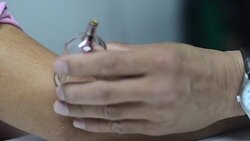 doctor treatment Stock Footage