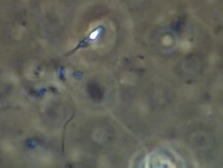 Single Human sperm swimming, big close up, Phase contrast Stock Footage