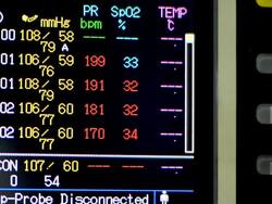 Blood pressure Stock Footage