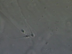 Two Human sperm swimming, Interference contrast Stock Footage