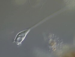 Vorticella feeding Stock Footage