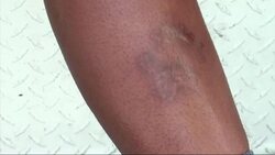 Dog Attacks on Mail Carriers Rise Again Instructional Video