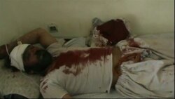 Suicide attack targets council building and police station Instructional Video