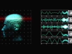 Brain Scan Display Stock Footage