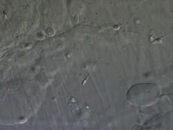 Single Human sperm swimming against the flow of semenal plasma, Interference contrast Stock Footage