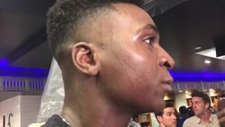 Yankees Win AL Wild Card Game, Beat Twins 8-4 Instructional Video